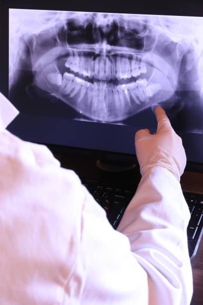 Best Emergency Treatment for Dental Infections or Abscesses in Leadwood, MO