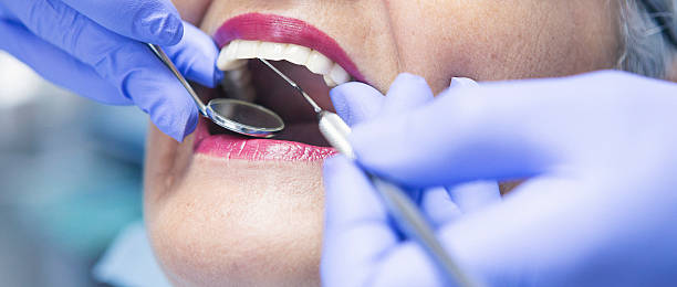 Best Emergency Wisdom Teeth Removal in Leadwood, MO
